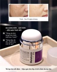 Kem Dưỡng Mờ Nám, Chống Lão Hóa Melatonin Liposome 5% Maxclinic Time Return Cream 50g