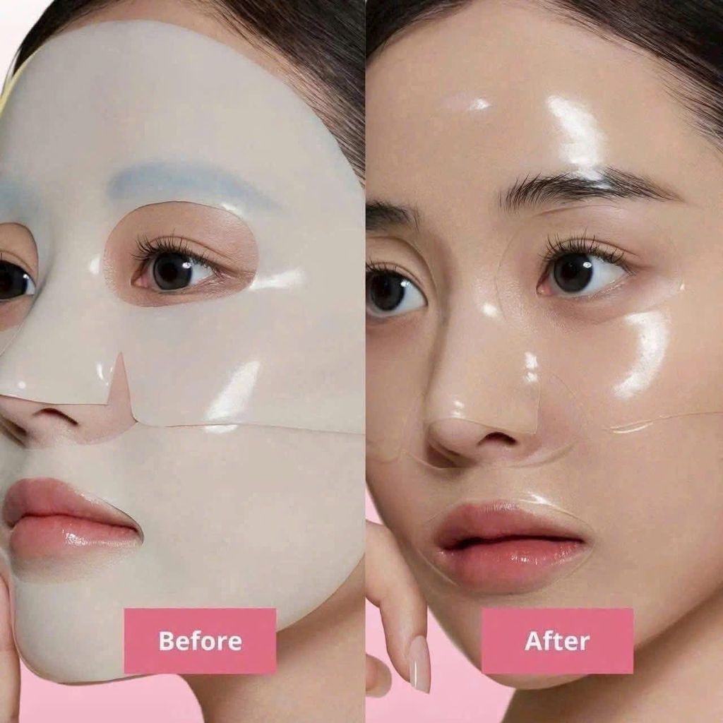 Mặt Nạ Thạch Medi Ansewr #Pore (Xanh) Mẫu Mới