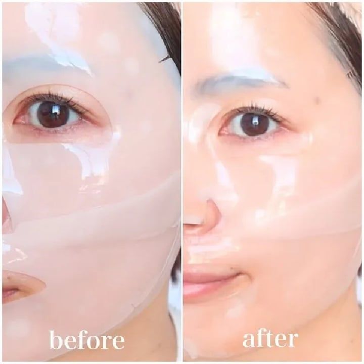 Mặt Nạ Thạch Medi Ansewr #Calming (Tím) Mẫu Mới