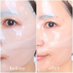 Mặt Nạ Thạch Medi Ansewr #Calming (Tím) Mẫu Mới