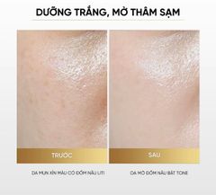 Kem dưỡng đêm Eirly's Alpha Melight 50ml