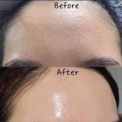 Dung Dịch Obagi Clenziderm M.D Pore Therapy Exfoliating BHA Toner 148ml (Mới-Ko Tđ)