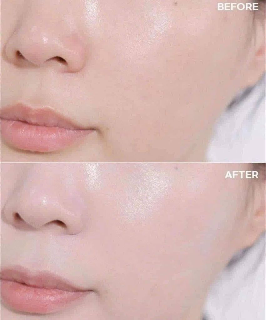 Set Kem Chống Nắng SU:M Losec Summa Tinh Chất Vàng SPF50+++ ( 3 sản phẩm)