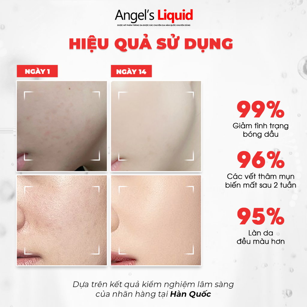 Tinh Chất Angle's Liquid Glutathione + Niacinamide Cica Ampoule 45ml ( Mẫu Nâng Cấp)