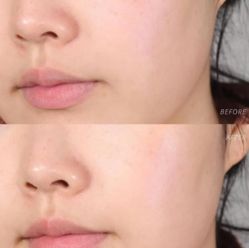 Tinh Chất Se Khít Lỗ Chân Lông Beplain Mung Bean Pore Tight Up Serum 30ml