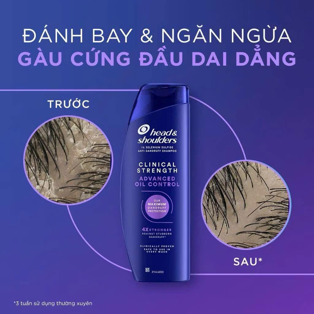 H&D - Dầu Gội Head & Shoulders Clinical Strength 400ml #Tím ( Nhập Khẩu)