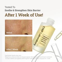 Tinh Chất Keo Ong Tái Tạo Phục Hồi Da CNP Laboratory 35ml