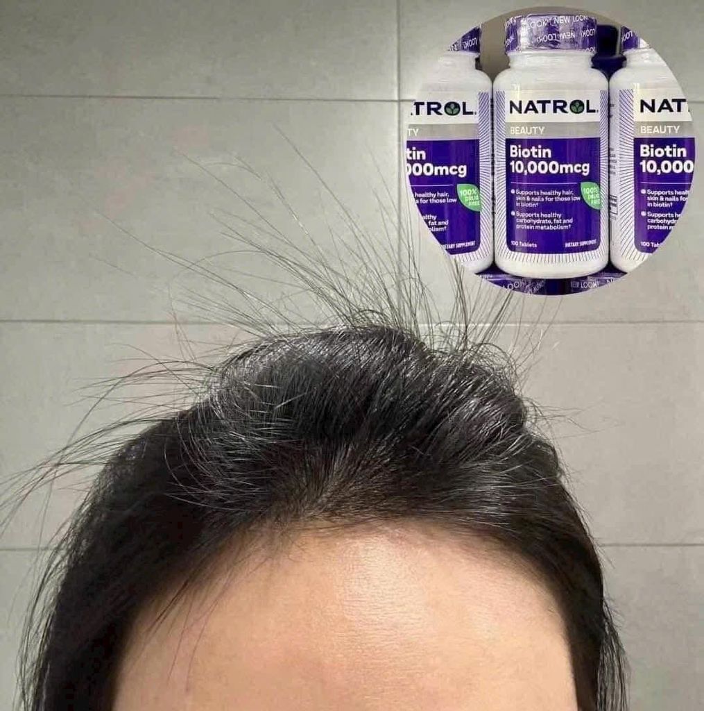 Viên Uống BIOTIN 10,000 mcg (Mẫu Mới)