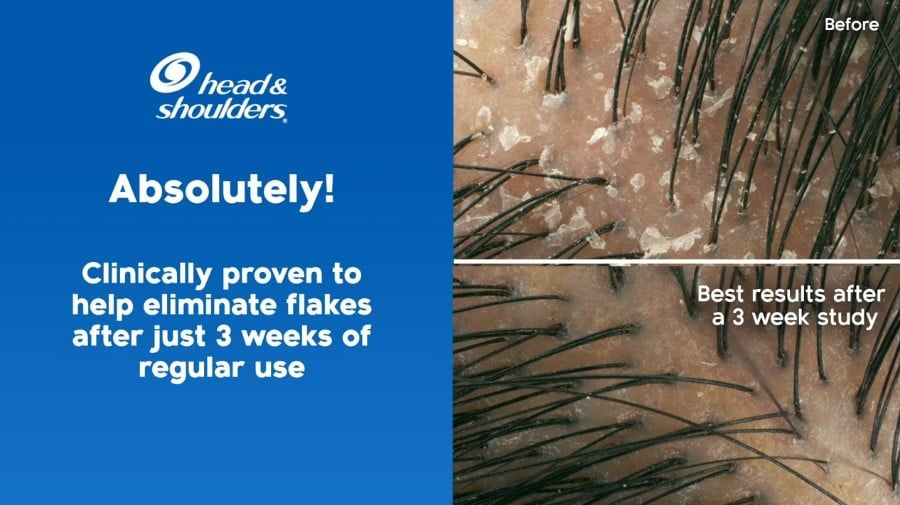 H&D - Dầu Gội Head & Shoulders Clinical Strength 400ml #Xanh (Mẫu Mới)