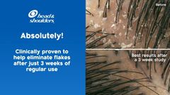 H&D - Dầu Gội Head & Shoulders Clinical Strength 400ml #Xanh (Mẫu Mới)