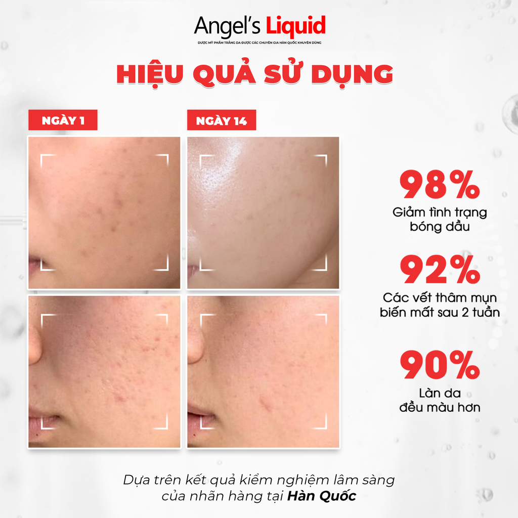 Kem Dưỡng Angle's Liquid Glutathione + Niacinamide Cica Ampoule ( Mẫu Nâng Cấp)