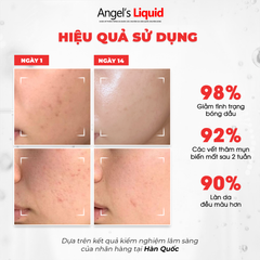 Kem Dưỡng Angle's Liquid Glutathione + Niacinamide Cica Ampoule ( Mẫu Nâng Cấp)