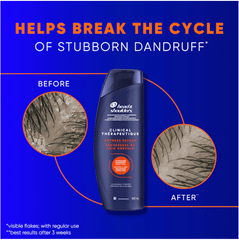 H&D - Dầu Gội Head & Shoulders Clinical Strength 400ml #Cam