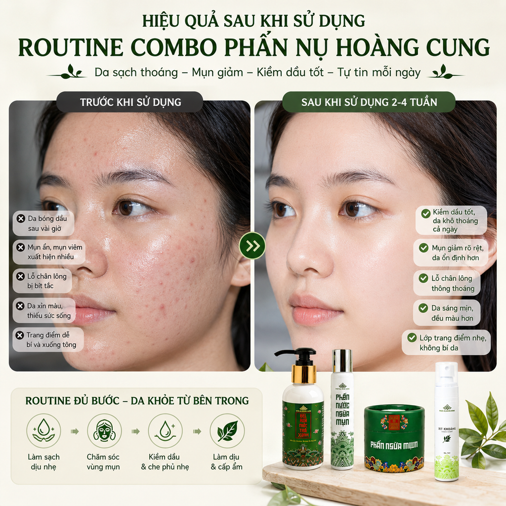 Liệu Trình Giảm Mụn Cho Da Dầu Mụn Phấn Nụ Hoàng Cung (Gel Trà Xanh+Phấn Nước Ngừa Mụn+Phấn Mụn tặng 1 Xịt Khoáng)