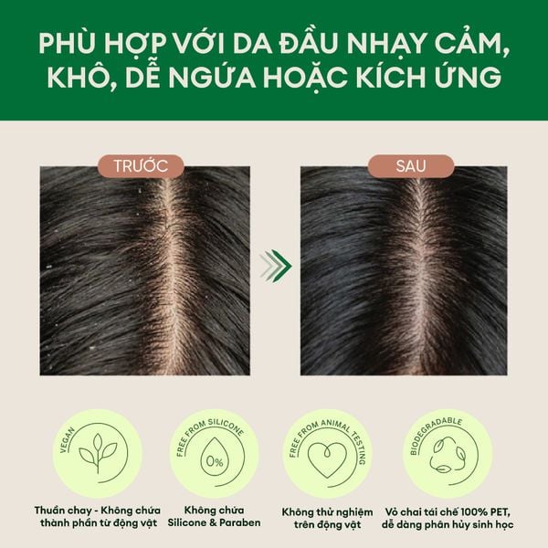 Dầu gội chăm sóc đặc biệt dành cho da đầu nhạy cảm Rausch Heartseed 40ml