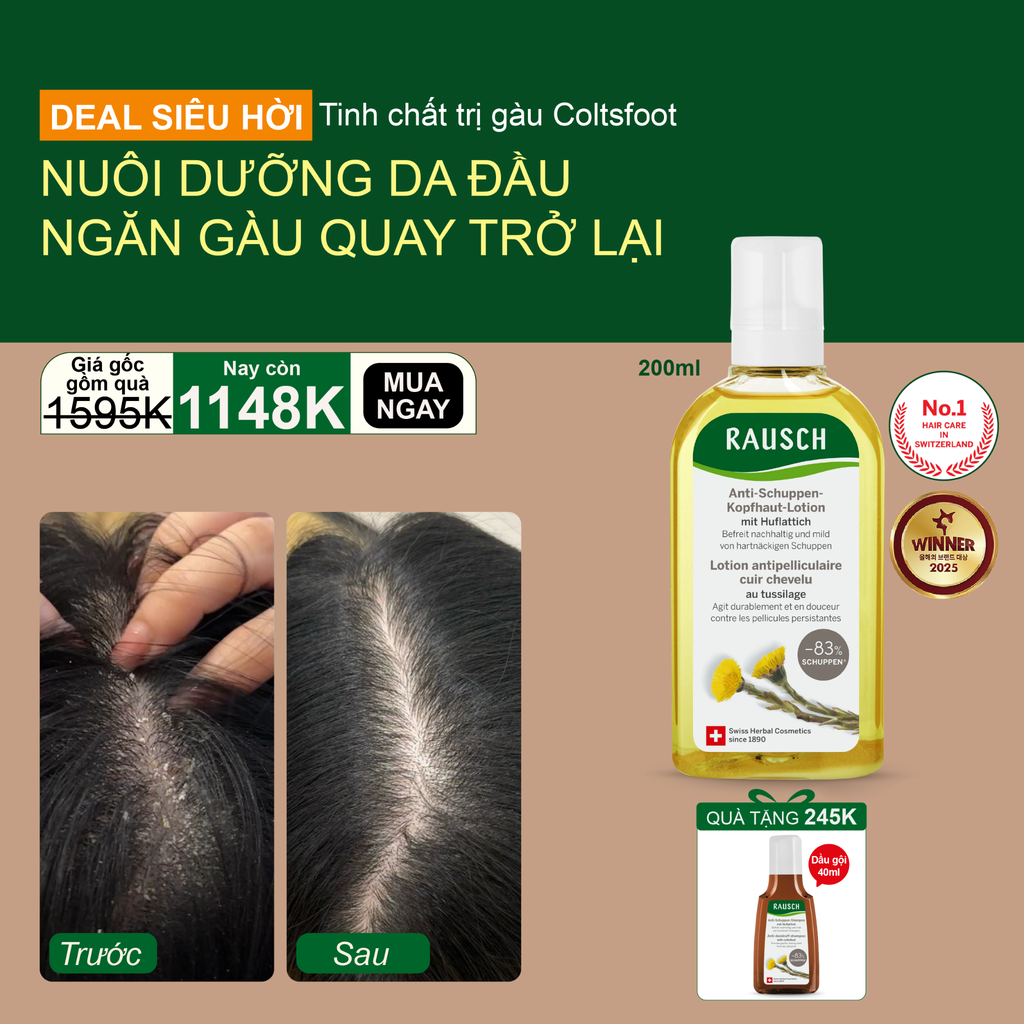 Tinh chất giảm ngứa, sạch gàu Rausch Coltsfoot Cúc Khoản Đông Hoa, thảo dược Thụy Sĩ 200ml