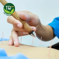 Nhang ngải cứu, dụng cụ diện chẩn 100% tự nhiên (điếu ngải diện chẩn), đánh bay các chứng cảm lạnh chân tay, xương khớp