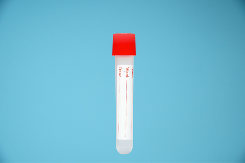  Ống nghiệm nhựa PP 5ml & 10ml HTM ống xét nghiệm thường - Tùy chọn 