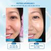  Serum Peptide Chống Lão Hoá Chuyên Sâu Argireline® Amplified 25ml 