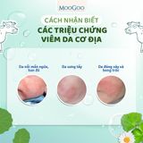  KEM DƯỠNG DA CHIẾT XUẤT RAU MÁ DÀNH CHO DA NHẠY CẢM, VIÊM DA CƠ ĐỊA - MOOGOO 