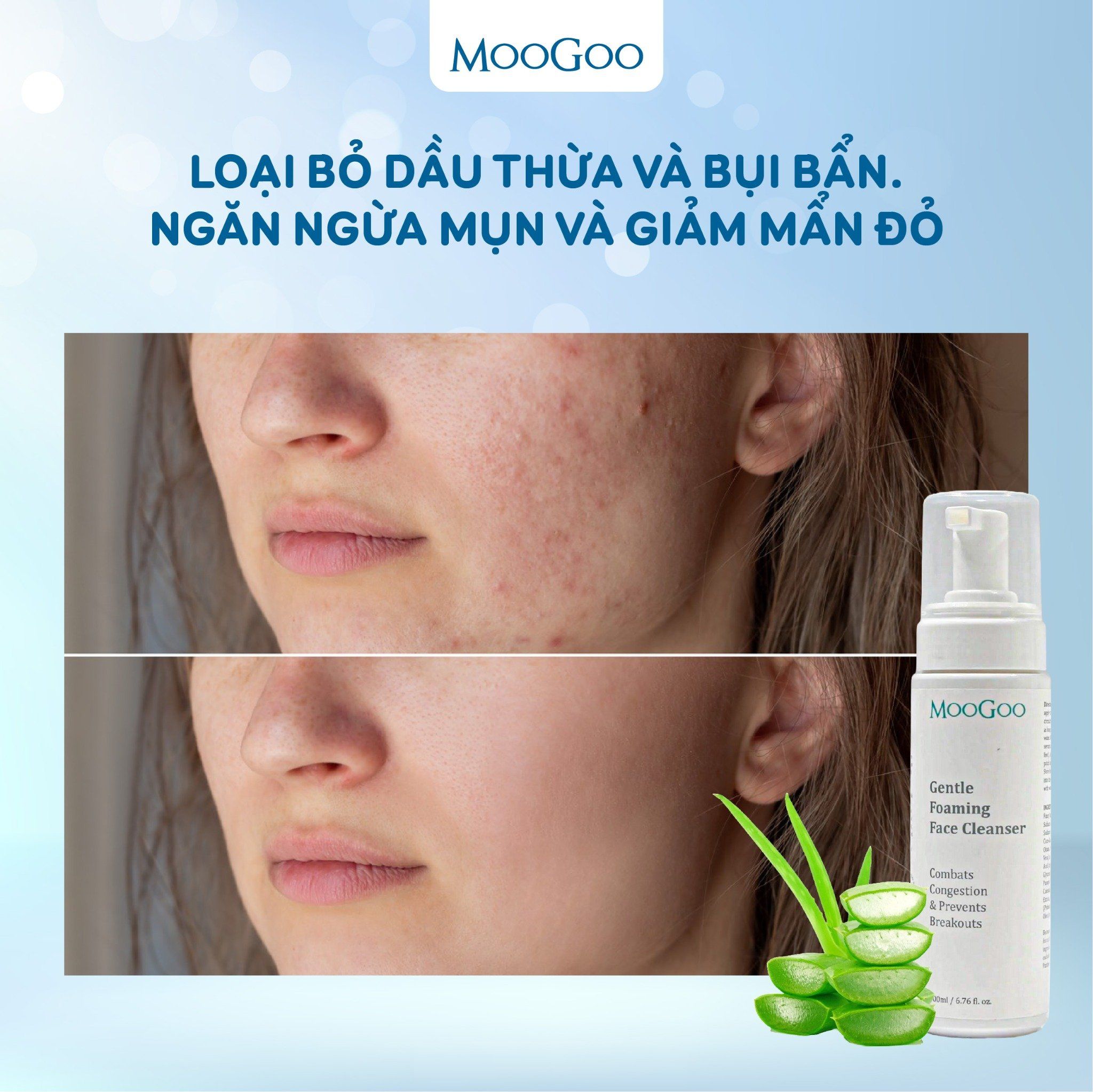  SỮA RỬA MẶT TRẮNG DA, KIỀM DẦU, CHỐNG MỤN, CHIẾT XUẤT HOA CÚC VÀ ĐU ĐỦ - MOOGOO 