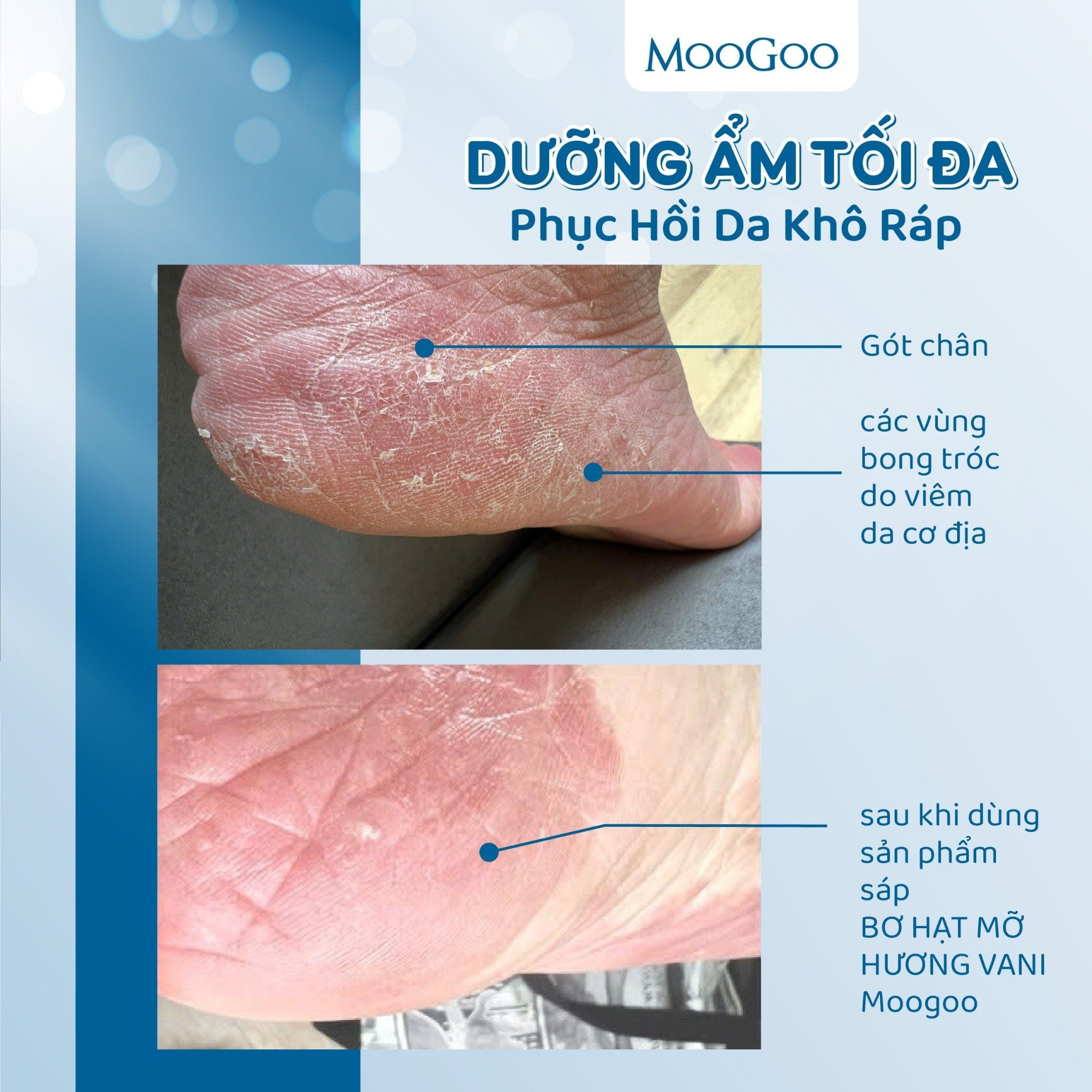  SÁP DƯỠNG - DƯỠNG BƠ HẠT MỠ VANI CHO DA SIÊU KHÔ, NỨT NẺ - MOOGOO 
