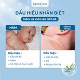  KEM DƯỠNG ẨM LÀM ẤM CHIẾT XUẤT TINH DẦU TRÀM, HỖ TRỢ VIÊM DA TIẾT BÃ - MOOGOO 