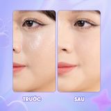  Kem Che Khuyết Điểm myKella Che Phủ Hoàn Hảo, Phù Hợp Với Mọi Loại Da - Magic Creamy Concealer 5ml 