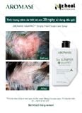  Dầu gội giảm gàu, làm dịu da đầu Aromase 5α Juniper MediPRO Simply Fresh Shampoo 80ml 