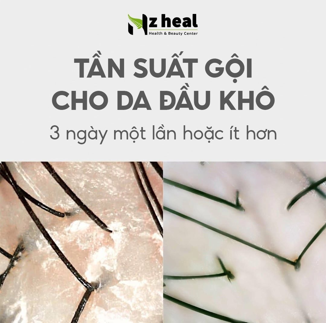  Dầu gội Aromase Dry Scalp Soothing Shampoo kiểm soát da đầu khô ngứa và gàu (90ml/ 400ml) 