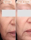  Liệu trình tinh chất peel da 2 bước DermEden Advanced Peel: Pre-Peel (trước thay da) & Peel (thay da) 