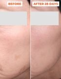  Liệu trình tinh chất peel da 2 bước DermEden Advanced Peel: Pre-Peel (trước thay da) & Peel (thay da) 