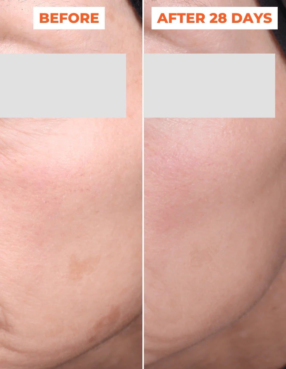  Liệu trình tinh chất peel da 2 bước DermEden Advanced Peel: Pre-Peel (trước thay da) & Peel (thay da) 