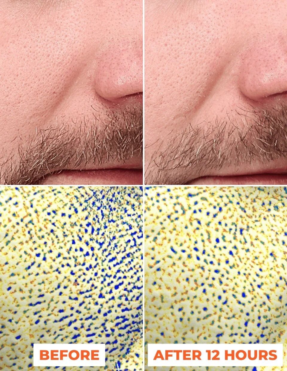  Liệu trình tinh chất peel da 2 bước DermEden Advanced Peel: Pre-Peel (trước thay da) & Peel (thay da) 