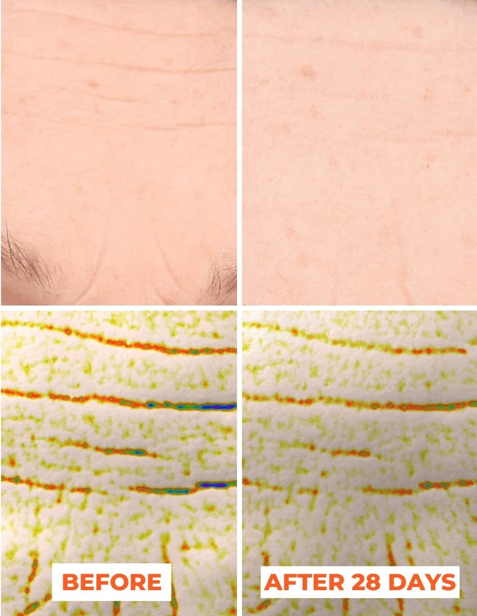  Liệu trình tinh chất peel da 2 bước DermEden Advanced Peel: Pre-Peel (trước thay da) & Peel (thay da) 