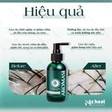  Xịt dưỡng và cấp ẩm cho da đầu khô Aromase Herbal Scalp Care Spray 40ml 