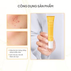 Kem Mờ Thâm, Sẹo Mụn Teenilicious Cream For Acne Scars 25g