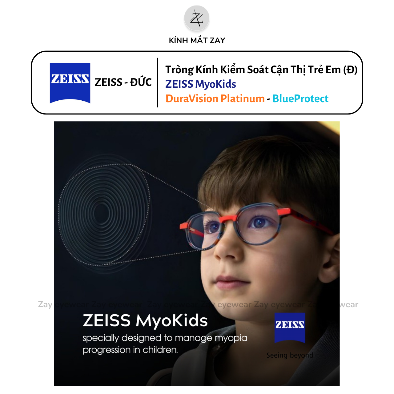  Tròng kính ZEISS MyoKids hỗ trợ kiểm soát cận thị trẻ em thế hệ mới theo vùng nhìn gần cao cấp chính hãng (ĐẶT ĐÁNH) 