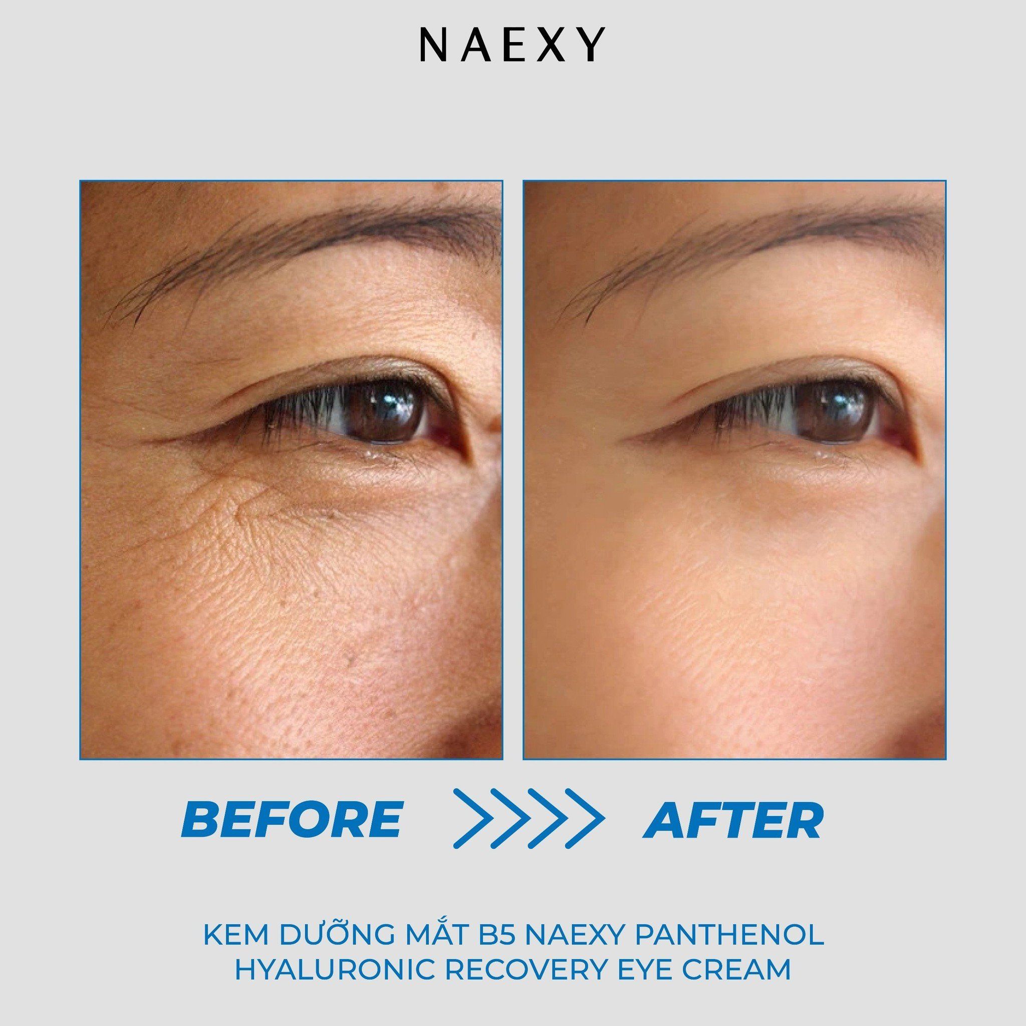 KEM DƯỠNG MẮT B5 NAEXY PANTHENOL HYALURONIC RECOVERY EYE CREAM 40ML