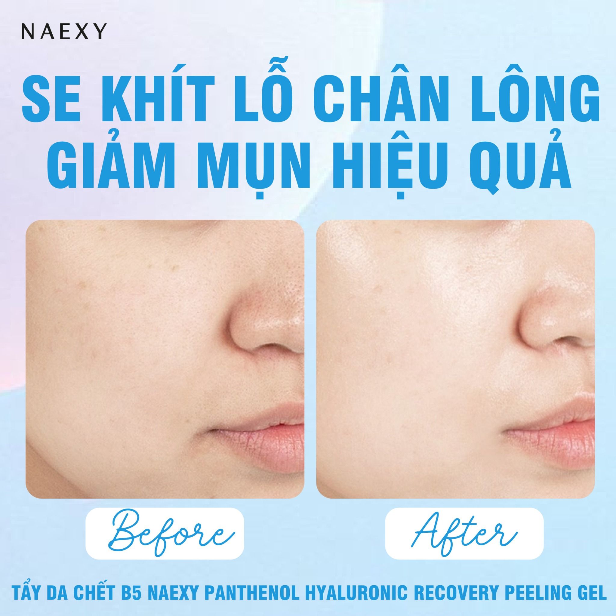 TẨY DA CHẾT B5 NAEXY PANTHENOL HYALURONIC RECOVERY PEELING GEL 150ML