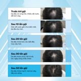  Máy gội đầu tự động AI |Smart AI  Hair Washing Machine 