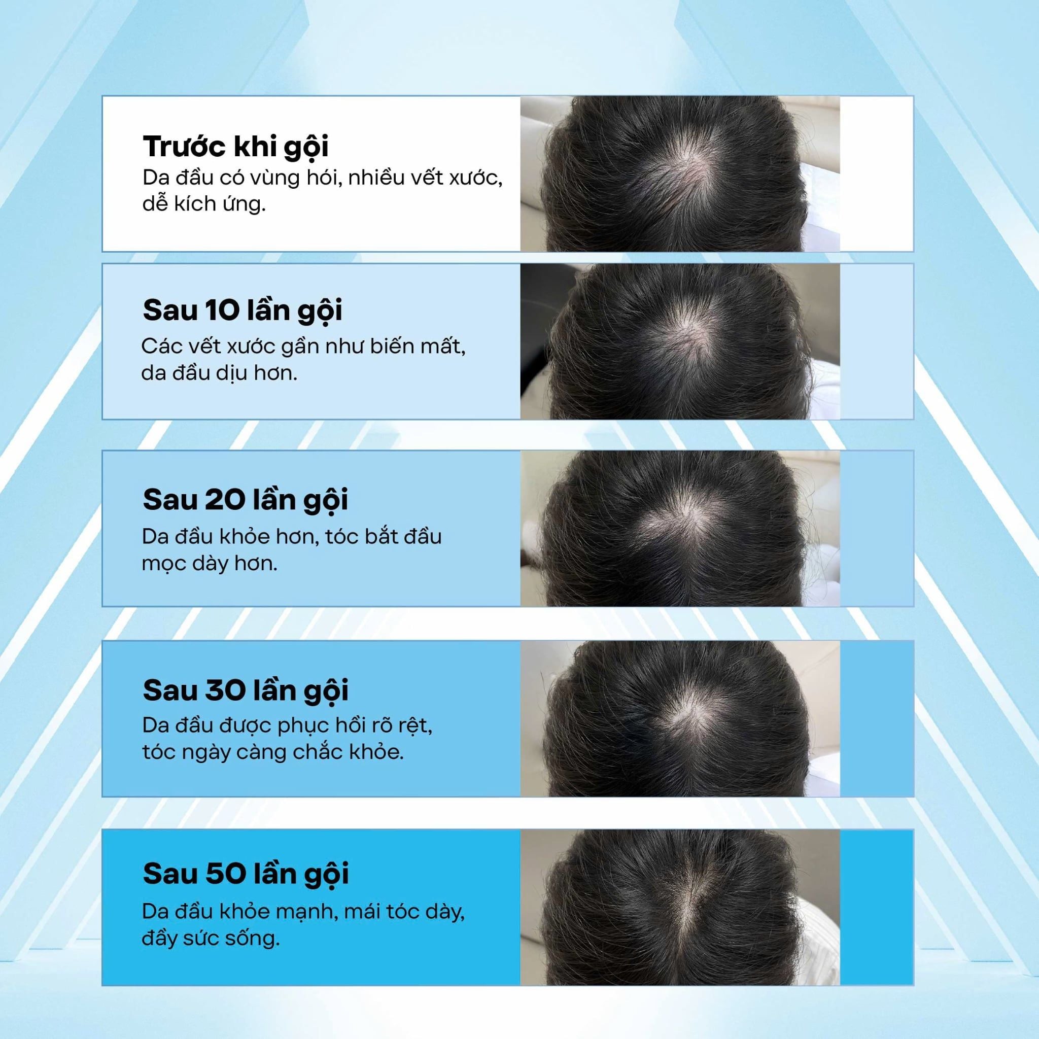  Máy gội đầu tự động AI |Smart AI  Hair Washing Machine 