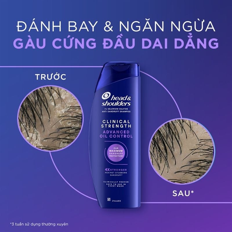 Dầu Gội Head & Shoulders Sạch Gàu Da Đầu Dầu Clinical Strength Advanced Oil Control 400ml