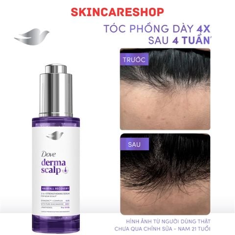 Serum Dove Derma Hairfall Recovery 3-in-1 Strengthening 45ml
