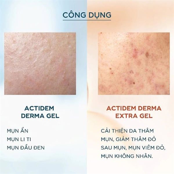 Gel Giảm Mụn Mờ Thâm Actidem Derma Extra Gel 18g