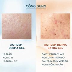 Gel Giảm Mụn Mờ Thâm Actidem Derma Extra Gel 18g