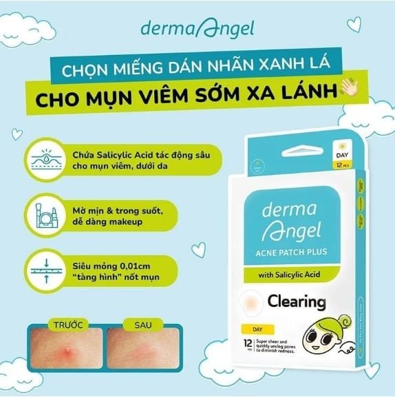 Miếng dán mụn Derma Angel Acnes Patch Plus - Salisylic Acid