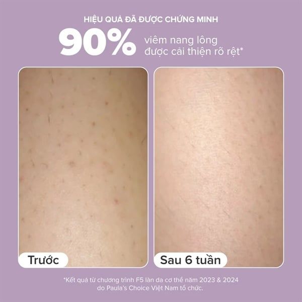 Kem Dưỡng Thể Paula's Choice 2% BHA Body Smoothing Spot Exfoliant 210ml