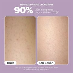 Kem Dưỡng Thể Paula's Choice 2% BHA Body Smoothing Spot Exfoliant 210ml