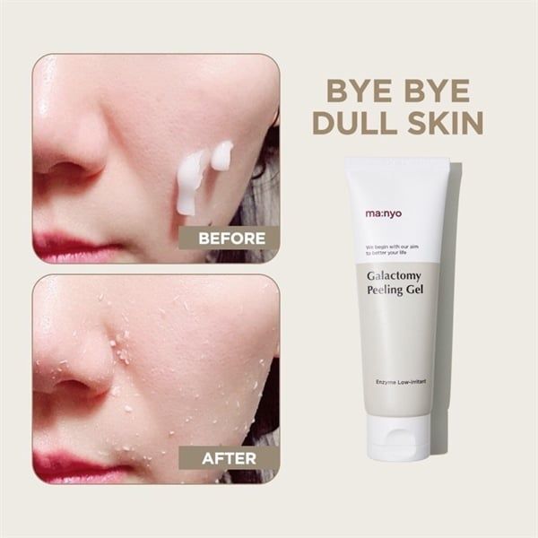 Tẩy Tế Bào Chết Da Mặt Dạng Gel, Dịu Nhẹ Manyo Galactomy Enzyme Peeling Gel 75ml
